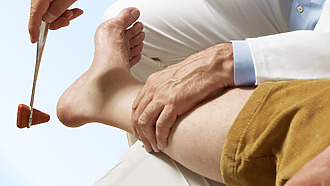 Příznaky periferní polyneuropatie: reflexy nefungují správně a pacienti cítí slabost v nohou.