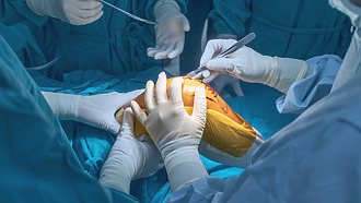 Operace kolena totální endoprotéza