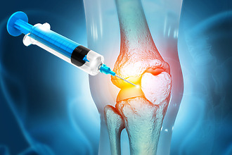 Kortikosteroidy ve formě injekcí, které se aplikují do kolene, tlumí bolest i zánět.