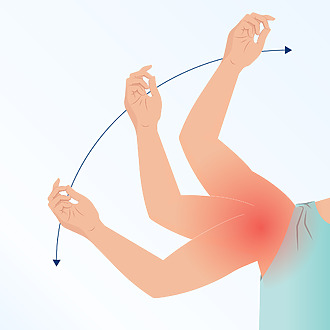 Bolest a omezení pohybu u zmrzlého ramene