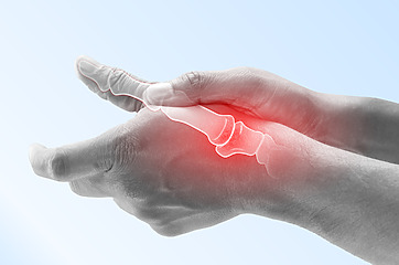 Pacienti mají oteklé klouby na prstech ruky a omezenou hybnost